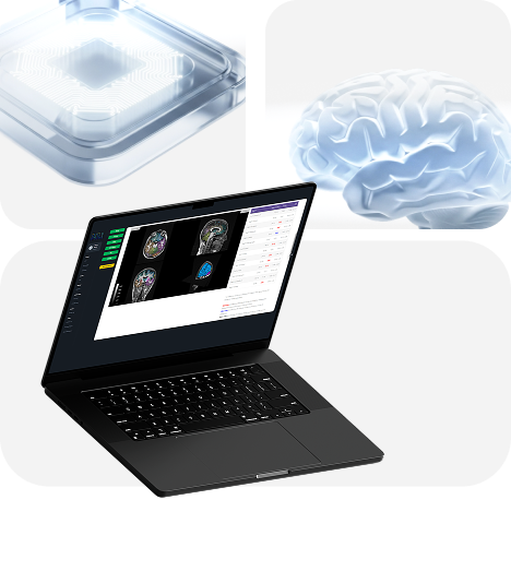 MRI Analysis